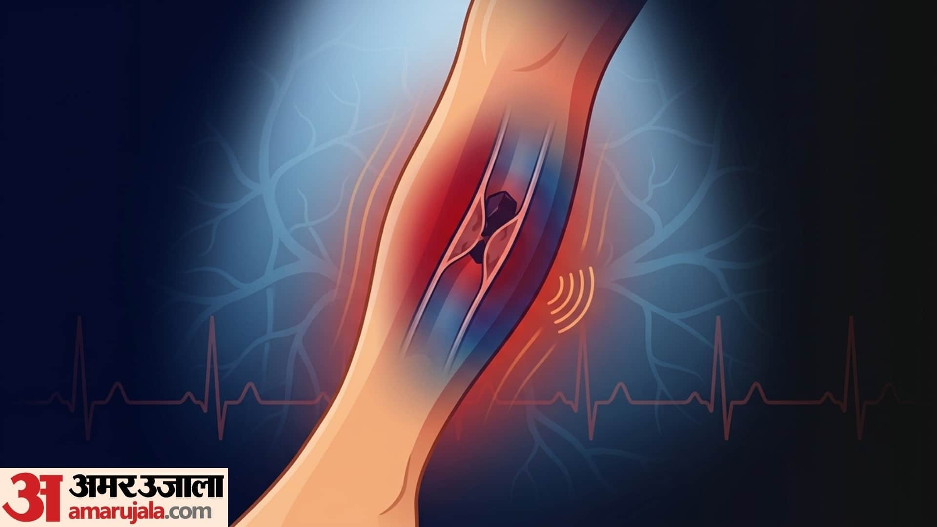 never ignore these symptoms of blood clotting after age of 60