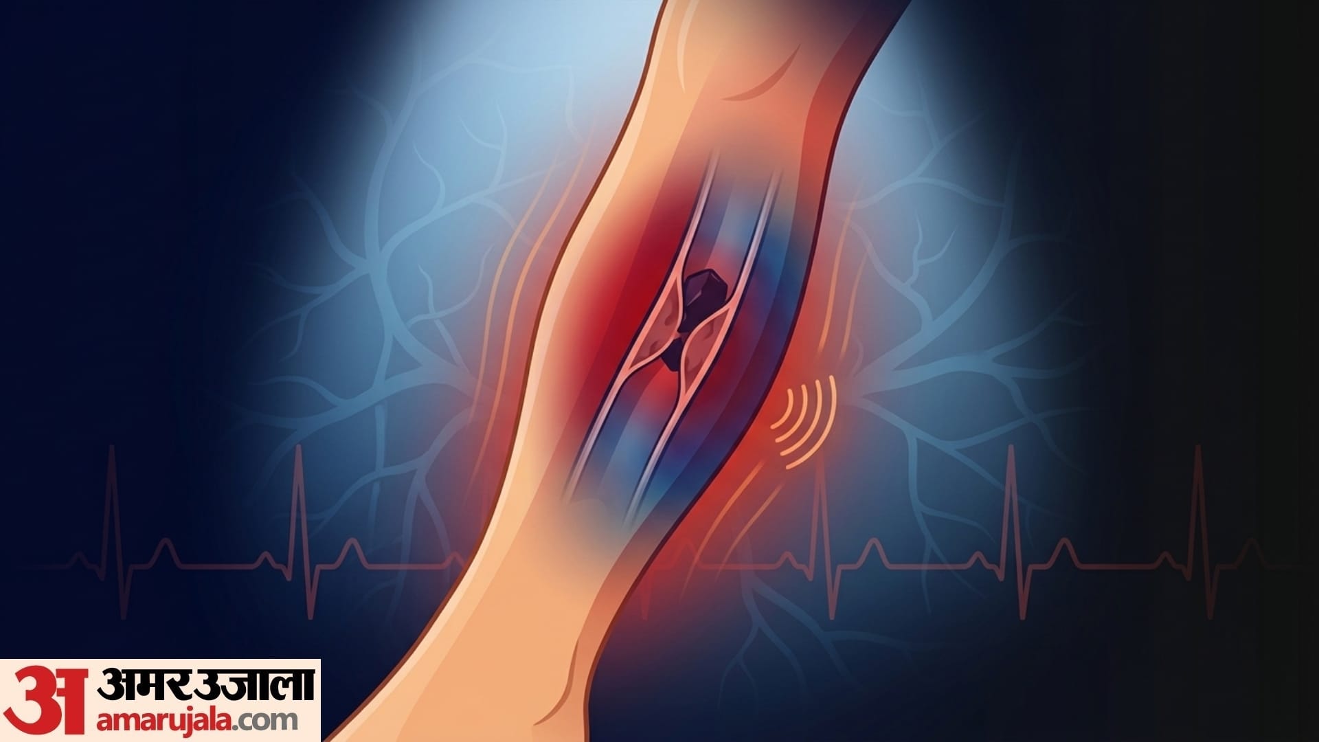 never ignore these symptoms of blood clotting after age of 60