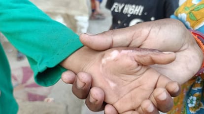 Kanpur Medical Tests Conducted on Innocent Victims of Brutality Fraudulent Social Worker Exposed