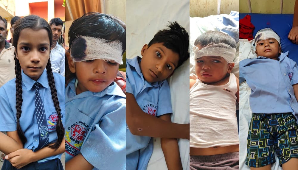 Hardoi Mishap on Ganga Expressway Service Road School Bus and Car Collide Violently Five Children Injured