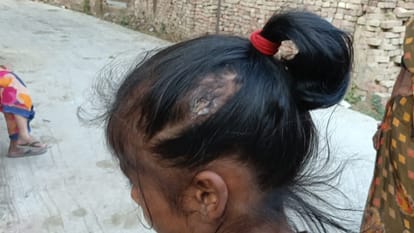 Kanpur Medical Tests Conducted on Innocent Victims of Brutality Fraudulent Social Worker Exposed