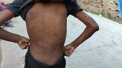 Kanpur Medical Tests Conducted on Innocent Victims of Brutality Fraudulent Social Worker Exposed