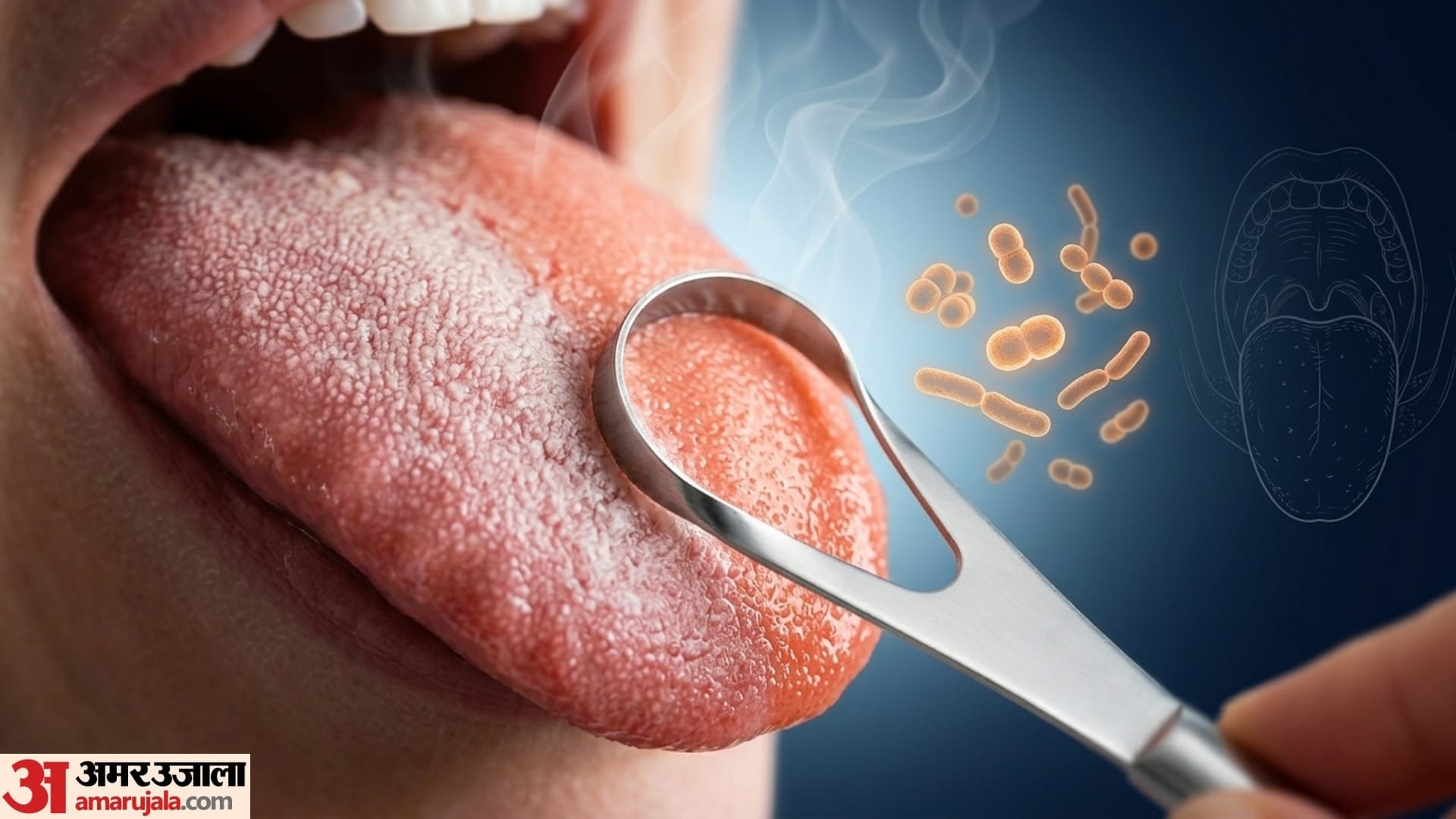 signs of cavity in teeth in hindi dant me kida lag jaye to kya kare gharelu upay