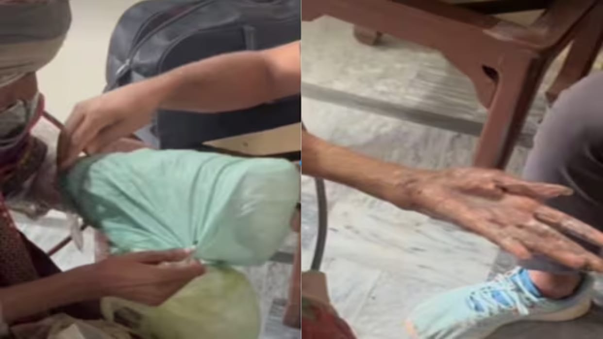 woman kept hundreds of plastic bag tied on her hand for three years to control her husband mental distress