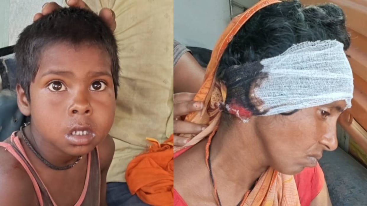 Bahraich: Woman fights leopard for 10 minutes to save her son, three people injured in attack
