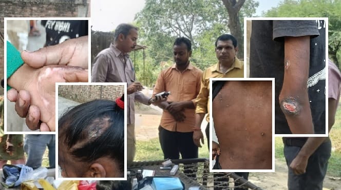 Kanpur four Orphan Rescued from Clutches of Uncle and Aunt Businessman Rajat Steps Up as Uncle