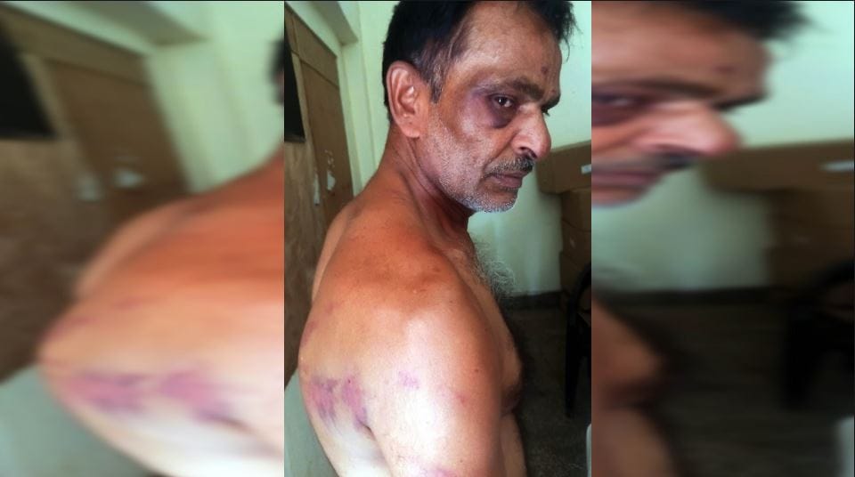 Man Held Hostage and Brutally Beaten for 4 Hours Over 1 Lakh Loan Dispute in Agra