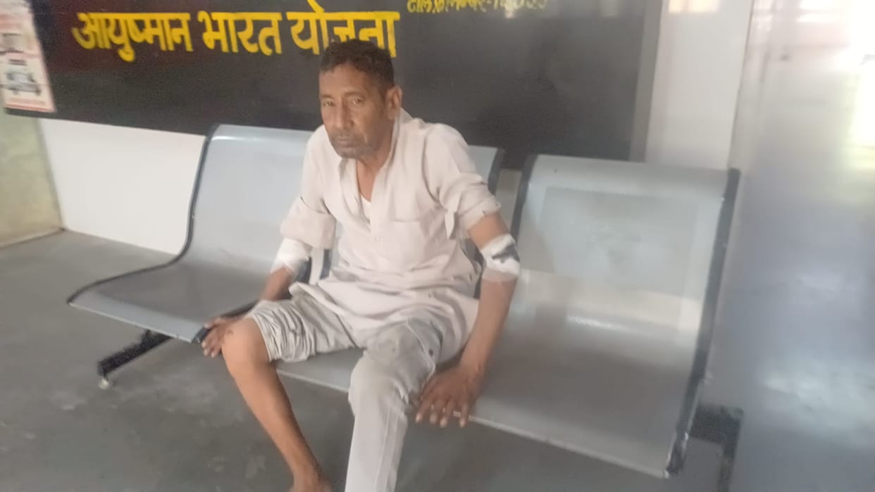 Baghpat: Five Injured in Separate Road Accidents in Baghpat, Three Referred to Higher Centre