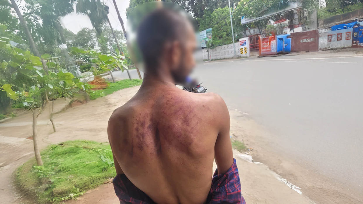 Purnia News: Polytechnic College Student Brutally Beaten By Hostel Boys In Ke-Hat Thana Area