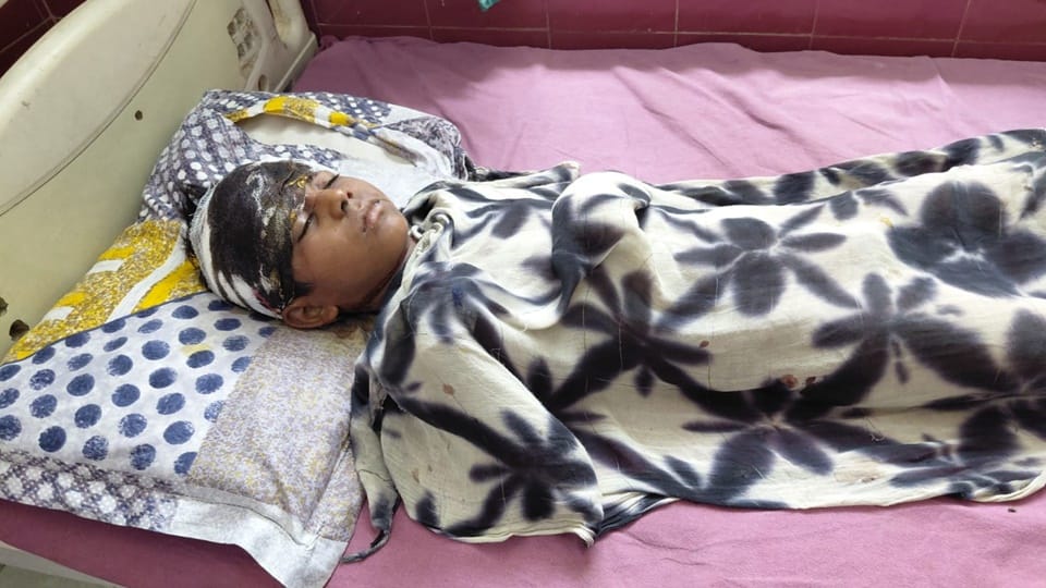 Rampur: 5th-Grade Student Mauled by Pack of Dogs; Attacked While Playing with Friends