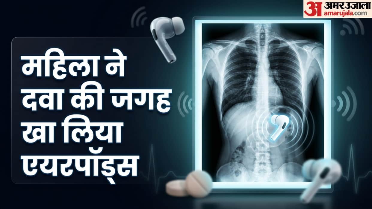 Woman accidentally swallows airpods instead medicine doctors shocked after hearing wierd sounds from stomach