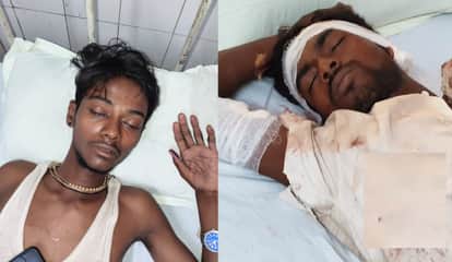 Auraiya Accident Two friends motorcycle crashes into divider injured after being thrown onto the road