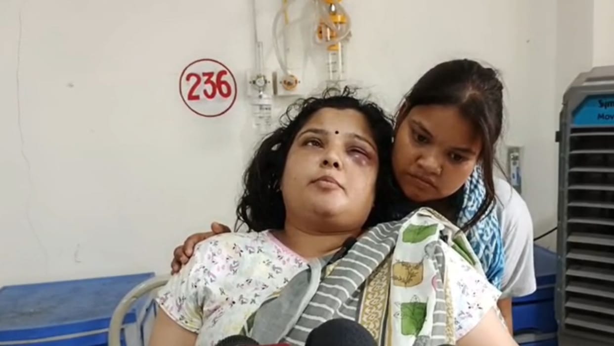 SP Women District President Gargi Singh Patel Brutally Beaten After Intruding into Her Home in Chandauli