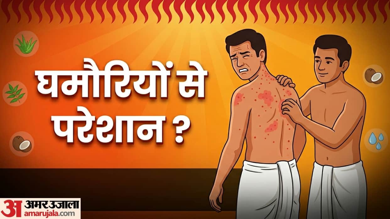 home remedy for prickly heat rashes on the body ghamoriya kaise theek karen gharelu upay