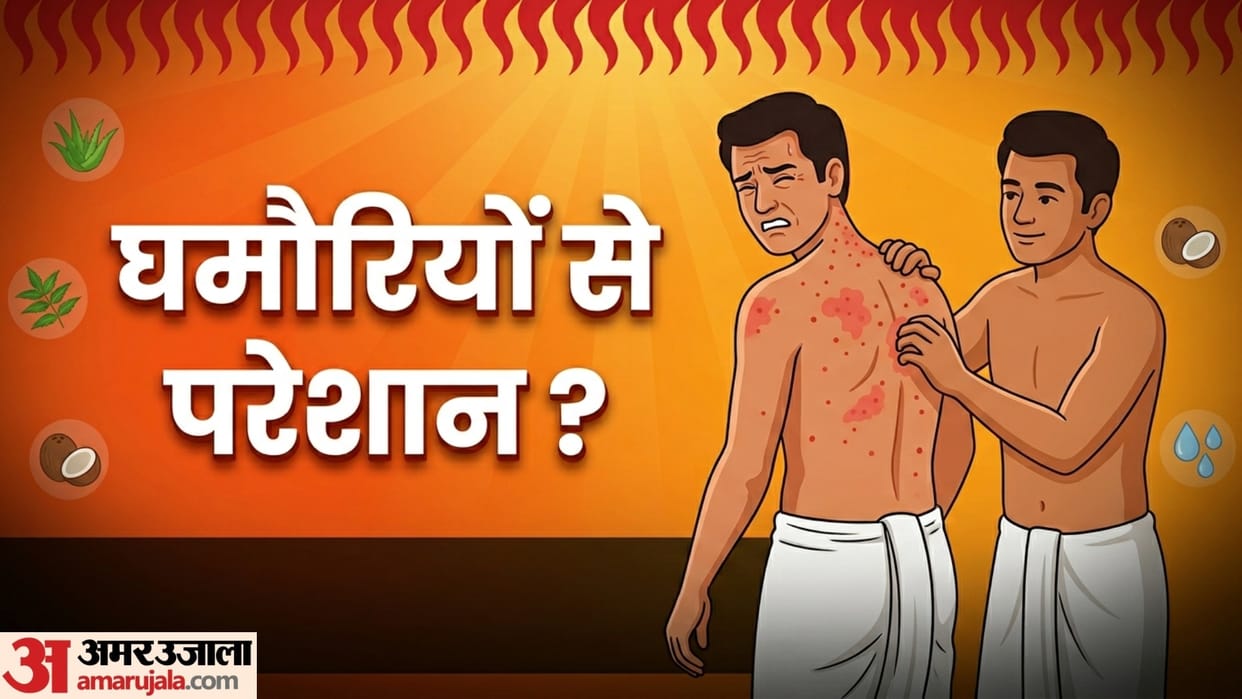 home remedy for prickly heat rashes on the body ghamoriya kaise theek karen gharelu upay