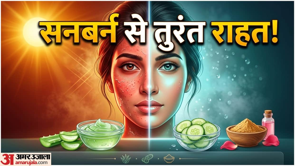 Home Remedies For Sunburn Natural Cooling Face Pack At Home In Hindi