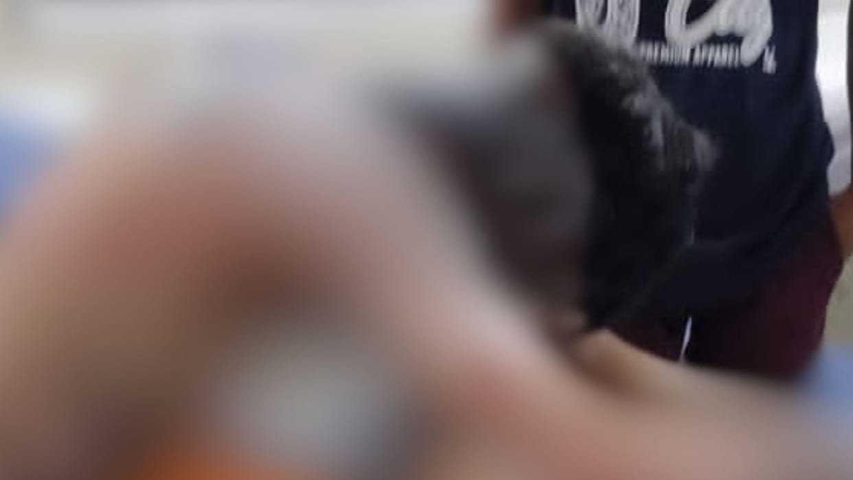 Young Man Sets Himself on Fire in varanasi Takes Drastic Step Following Dispute with Girlfriend