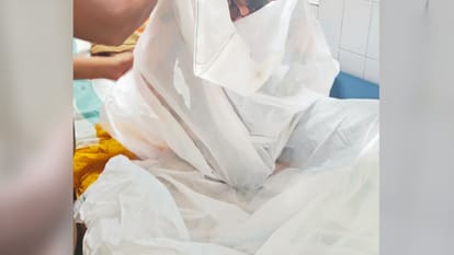 Young Man Sets Himself on Fire in varanasi Takes Drastic Step Following Dispute with Girlfriend