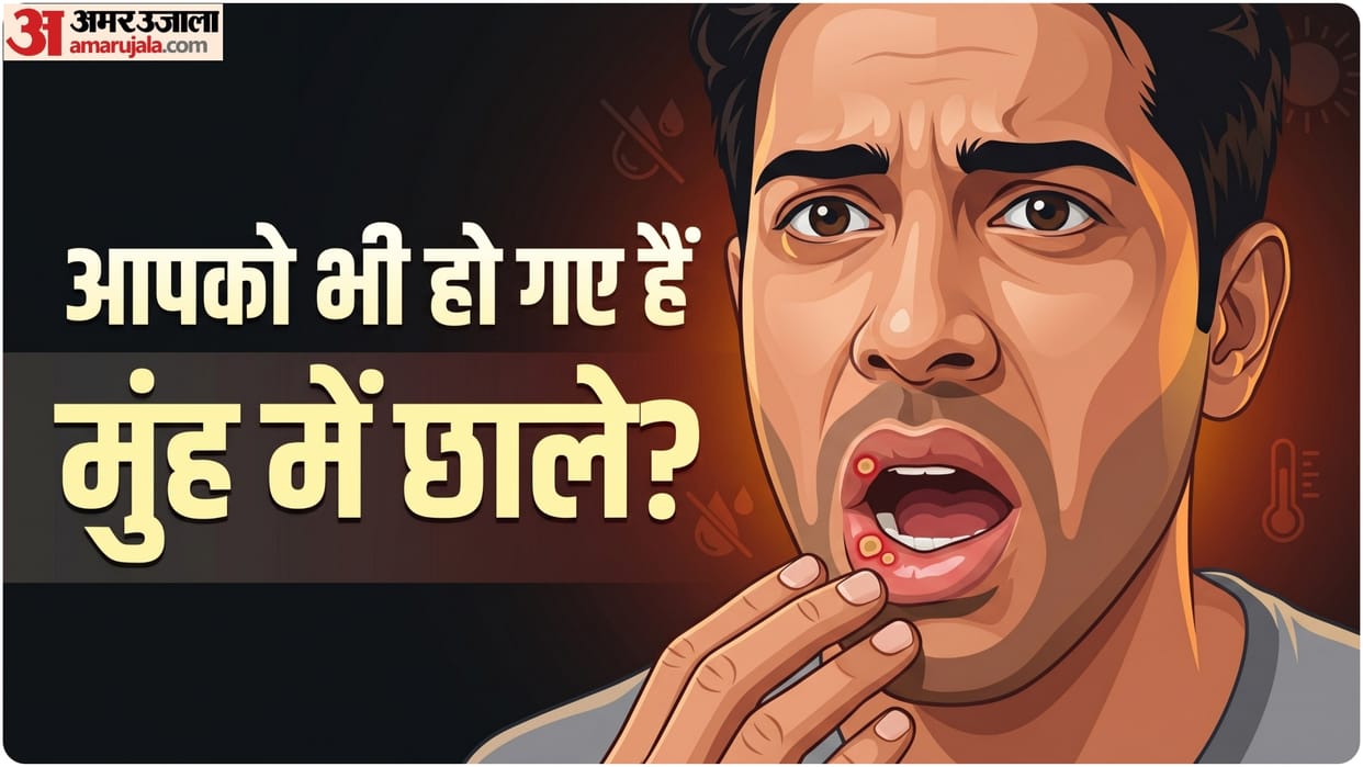mouth ulcer sore in summer know causes and treatment garmi me muh me chale kyu hote hai