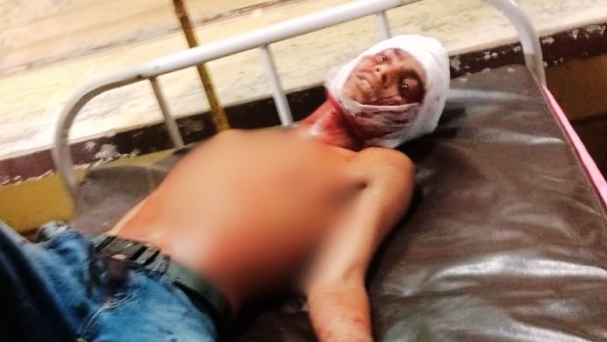 Youth Attacked with Knife at Community Feast Referred to District Hospital in Critical Condition