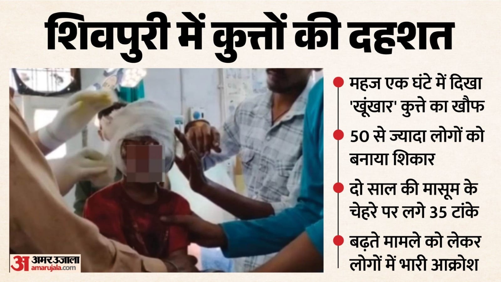दो साल की बच्ची पर आवार कुत्ते का हमला, उपचार जारी।