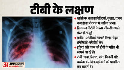 ear and bone TB cases are also emerging in Himachal 60 percent of patients suffer from pulmonary tuberculosis