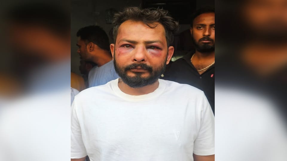 VHP city president Amit Verma was attacked in Gorakhpur Chauri Chaura