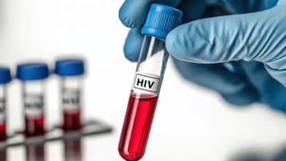 56 new HIV patients found in Raigarh in two months, 16 children under the age of 14 are also infected