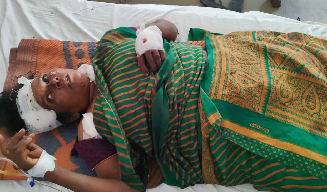 Unnao Drunken husband turns into a monster stabs wife repeatedly before bringing her to the hospital