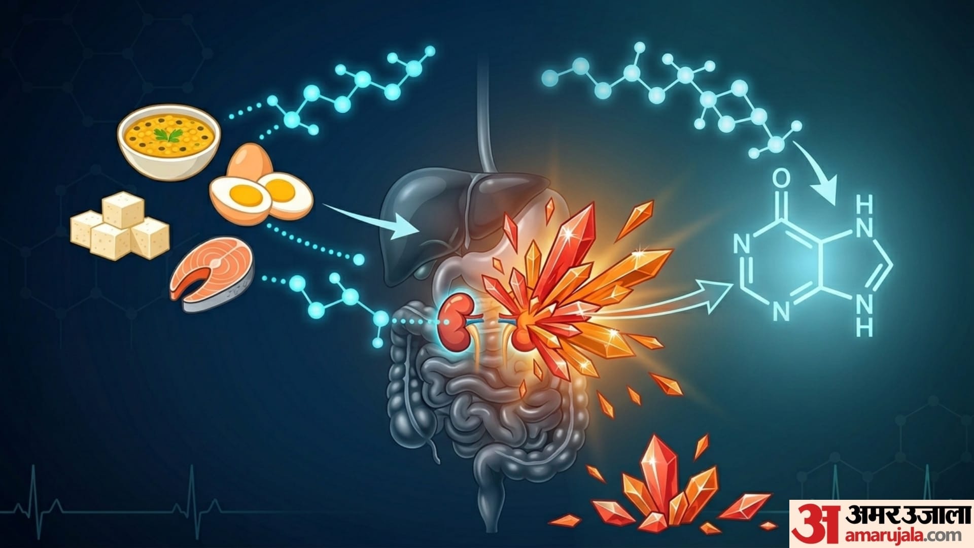 does high protein diet increase uric acid kya protein se uric acid badhta hai disprj