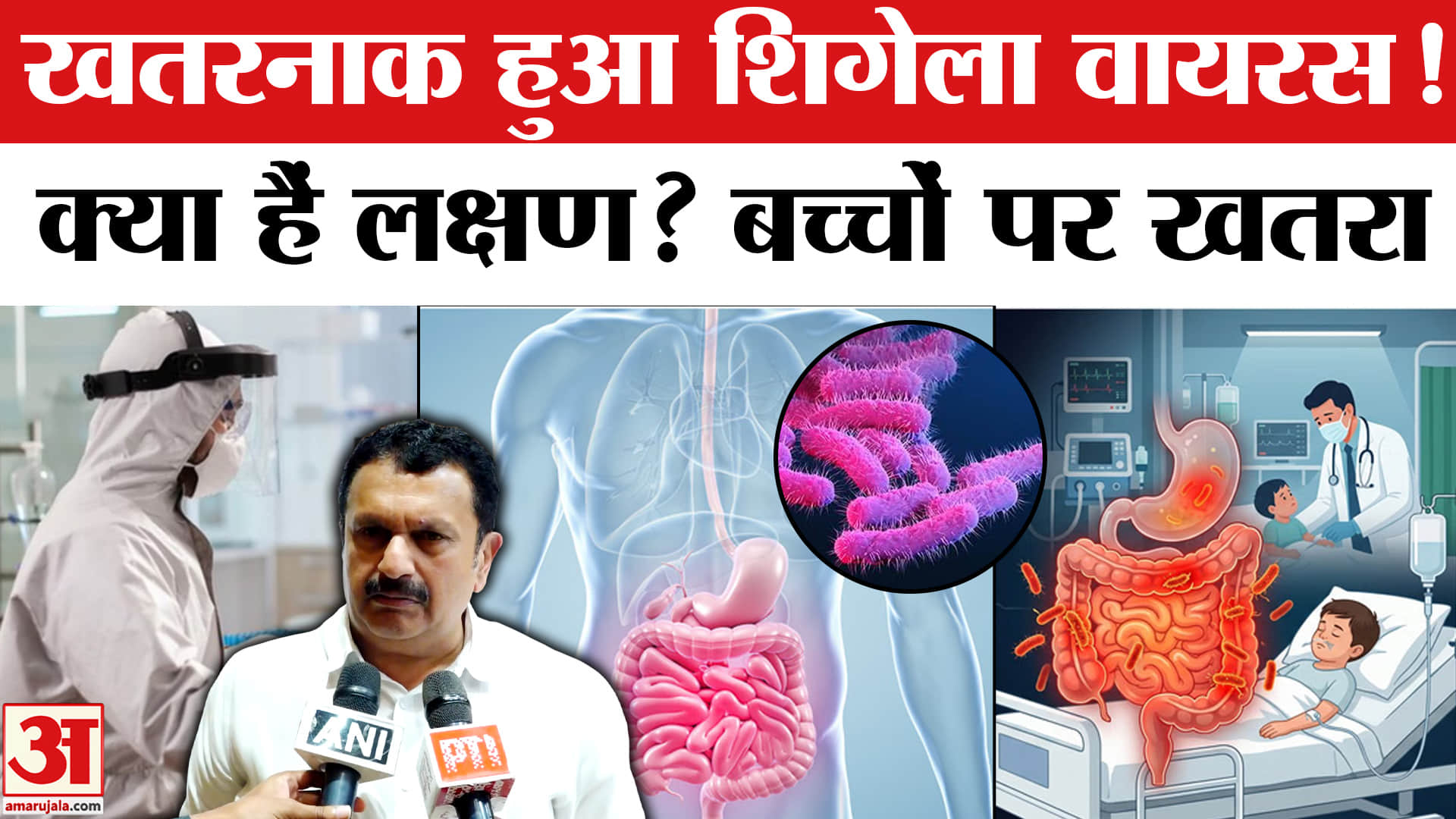 Shigella Infection