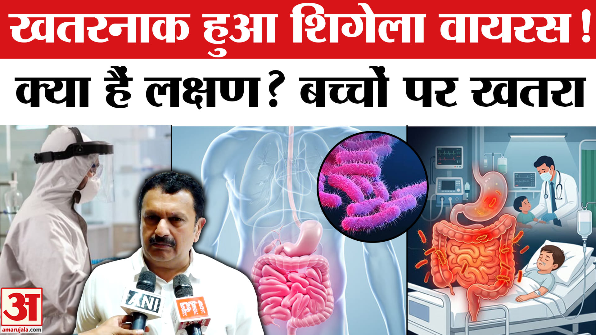 Shigella Infection