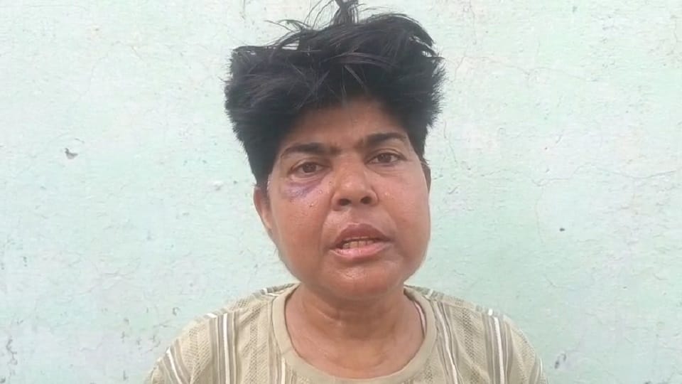 Agra custodial violence, police assault case, medical board report, Section 610 DK Basu guidelines, Supreme Co