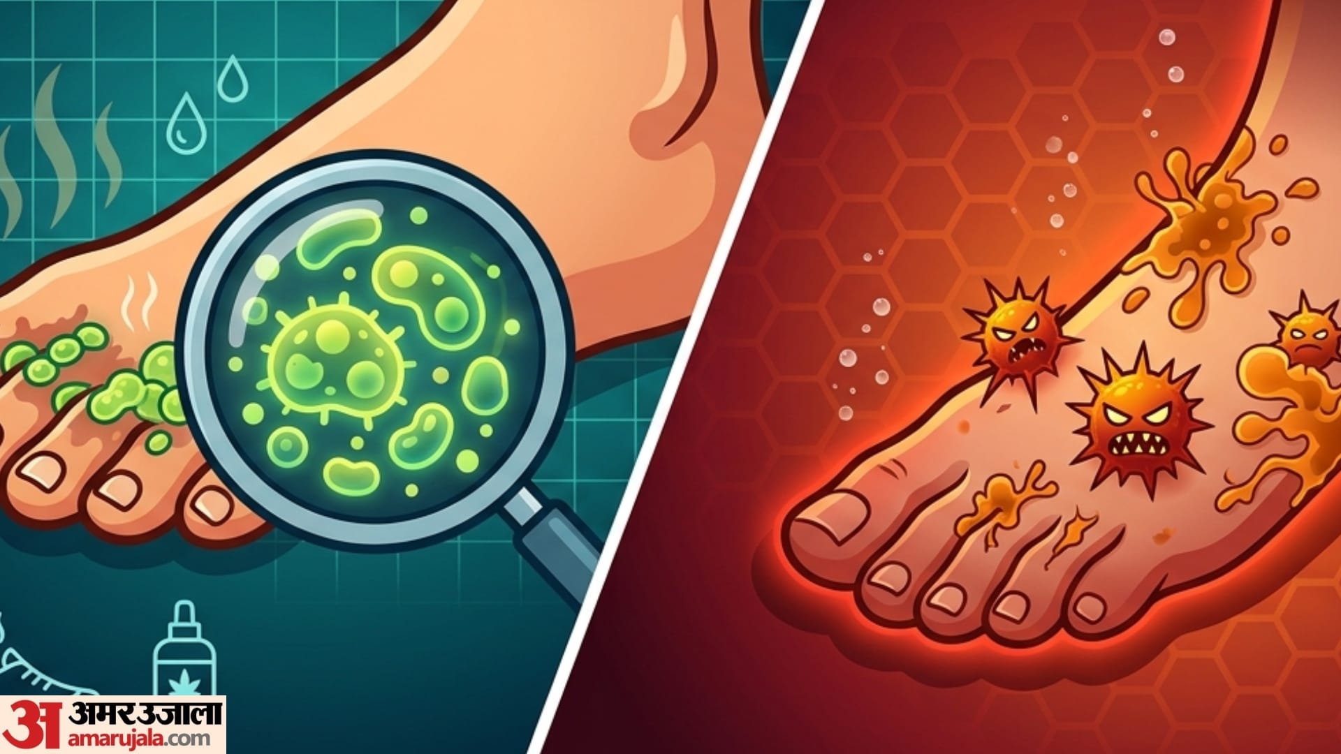 best remedy for fungal infection in foot fingers pairo se badbu aaye to kya kare
