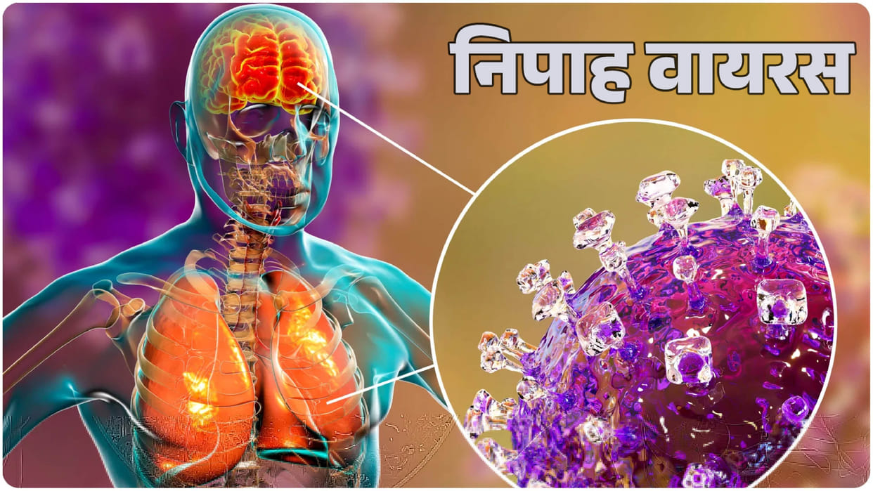 Threat of Nipah virus emerges in India; one patient detected in Kerala; high alert issued in the state.