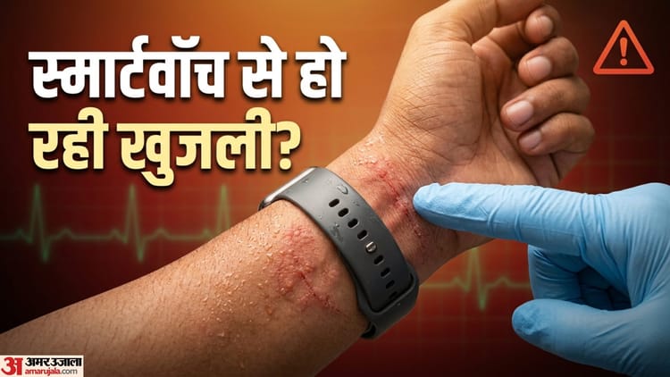 घड़ी पहनने से हो रही है खुजली? नजरअंदाज किया तो हो सकता है स्किन इन्फेक्शन