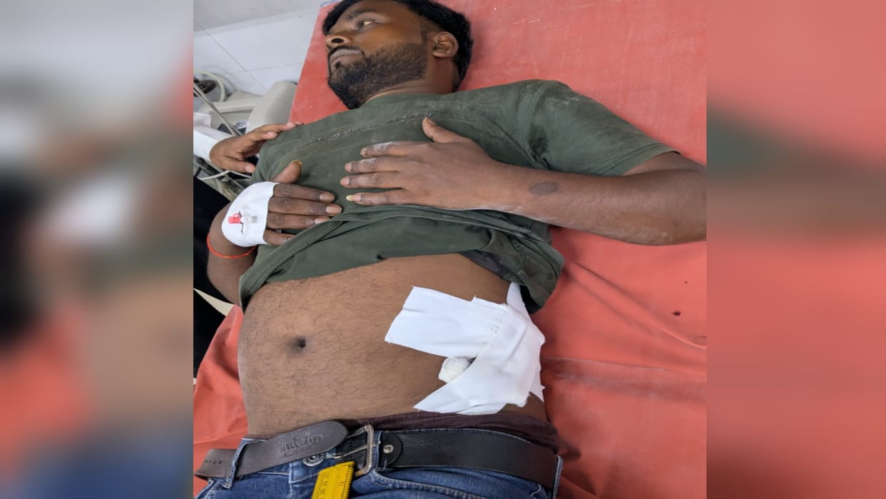 Police register FIR in case of fruit merchant being shot.