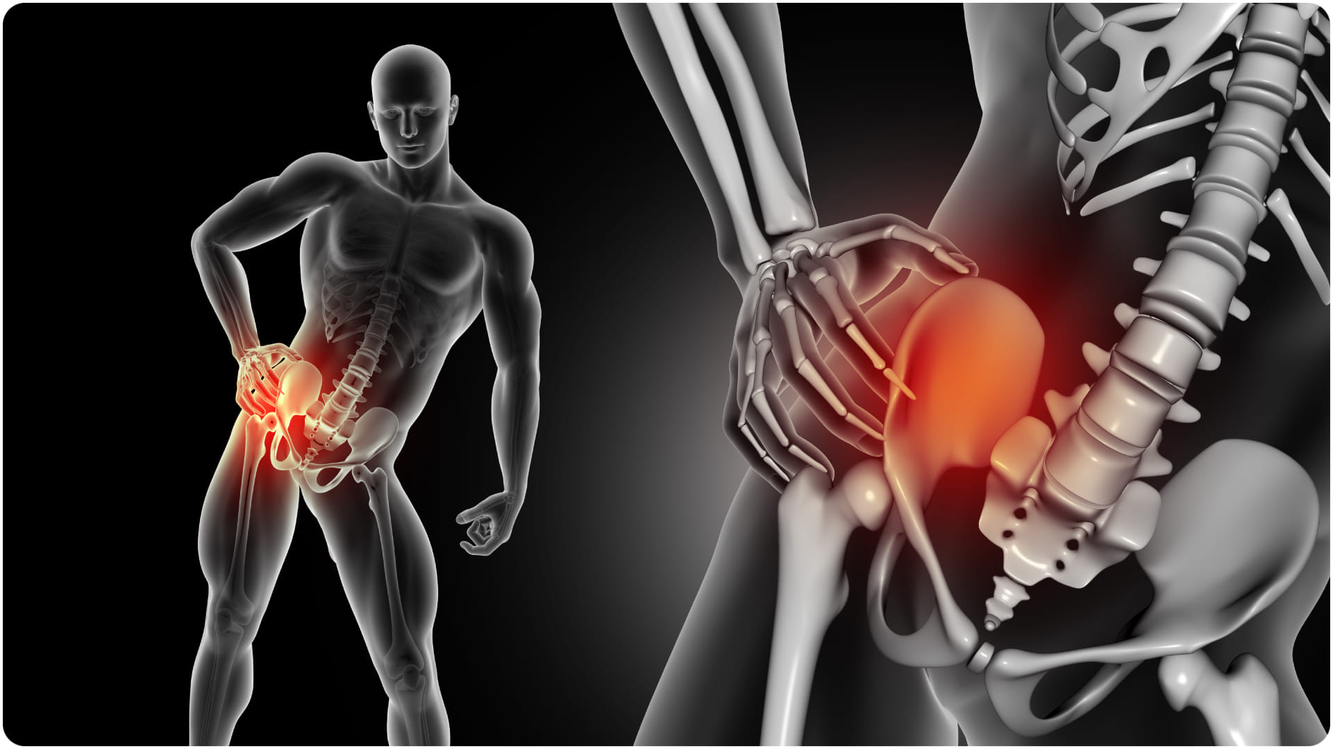 why hip replacement increasing in young patients know your risk factors