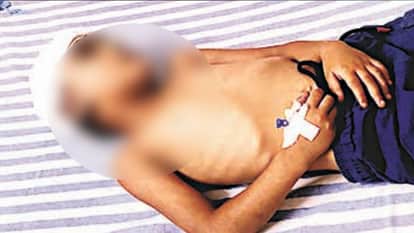 Drunk Man Throws Four-Year-Old Child to Ground in Meerut, Skull Fracture Reported, FIR Registered
