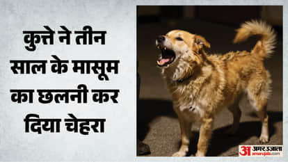 Mahi, 3, Mauled by Stray Dog: 55 Stitches on Face, Fight On to Save Eye