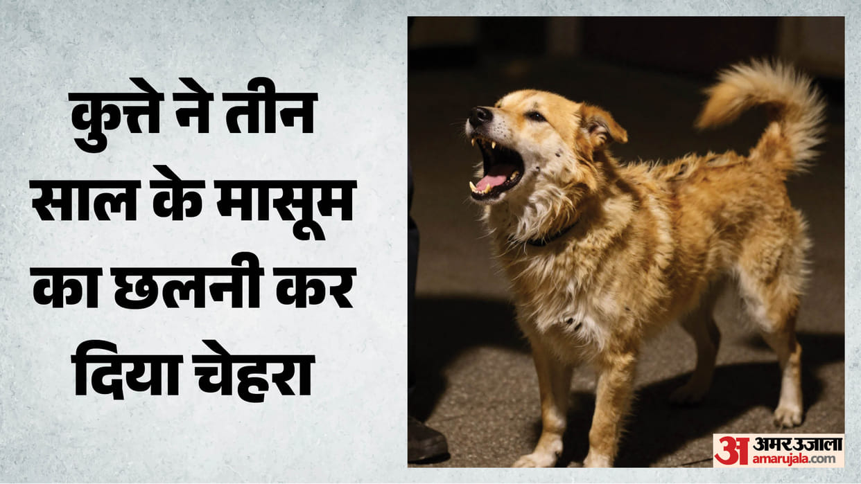 Mahi, 3, Mauled by Stray Dog: 55 Stitches on Face, Fight On to Save Eye