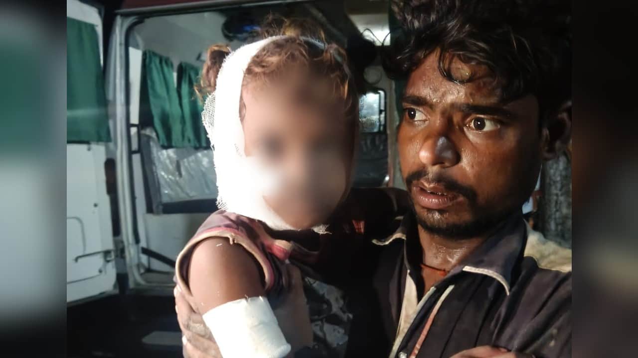 अपने पिता की गोद में घायल मासूम