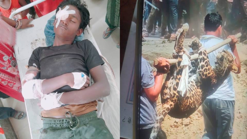 Leopard attacks young man in Shravasti condition critical man-eater also died shortly after