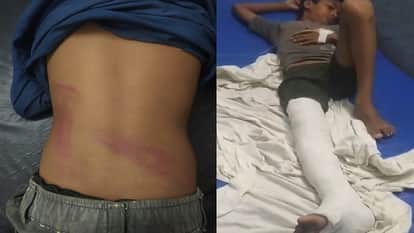 Innocent children playing on haystack attacked in Agra