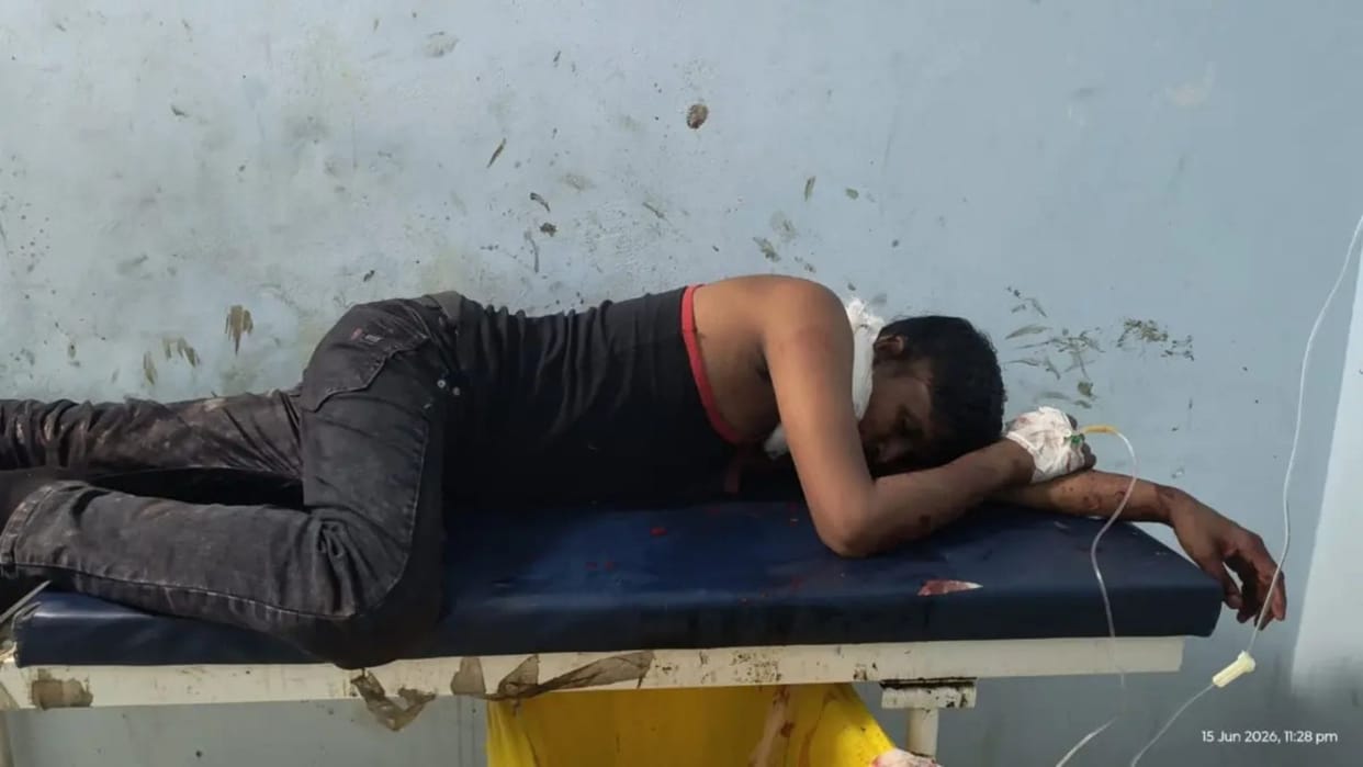 Encounter between police and liquor smugglers in Gopalganj smuggler shot in jaw bihar