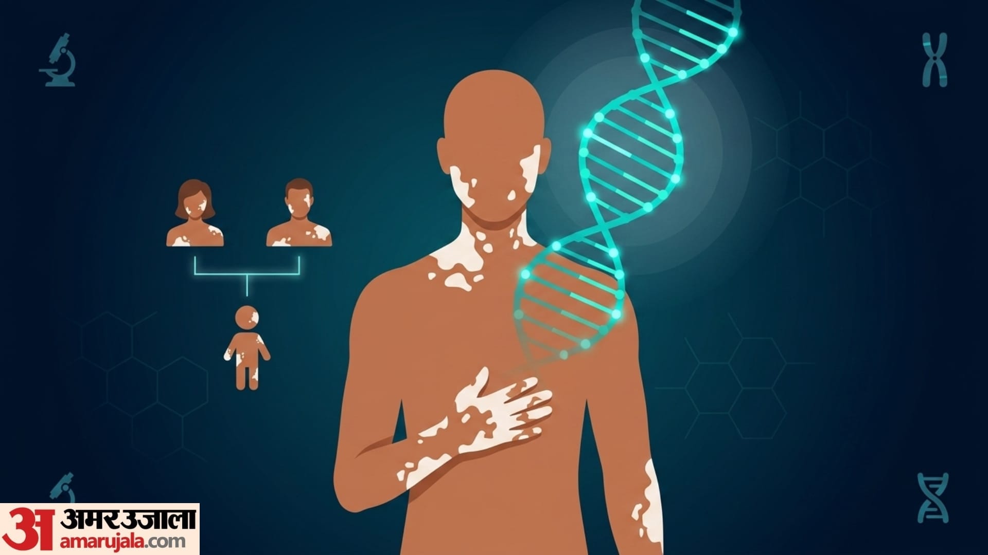 causes and treatment of vitiligo in hindi kya safed daag theek ho sakta hai