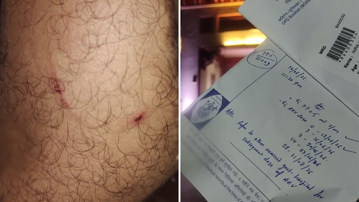 3 BHU guards accused beating student victim says beaten despite showing his ID card on mobile phone