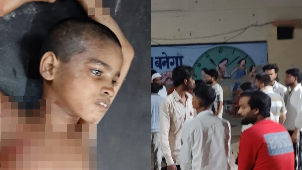 Amroha: Dogs kept mauling a helpless deaf-mute child; he writhed in pain