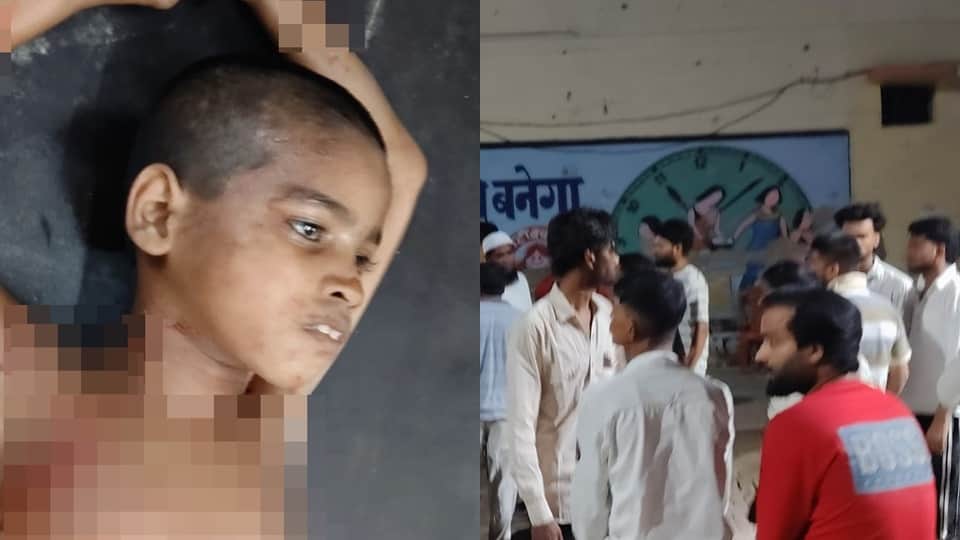 कुत्ते के हमले में मासूम जख्मी