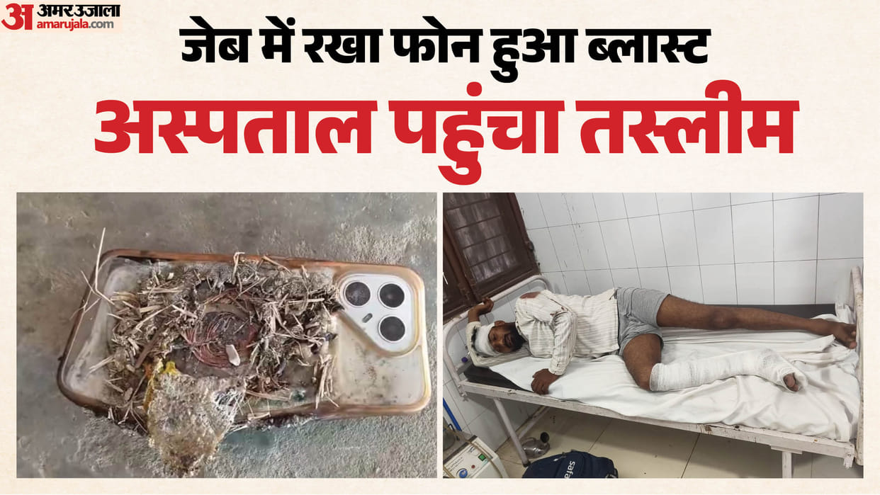 Mobile phone explodes in bike rider pocket after collision with truck injured hospitalized